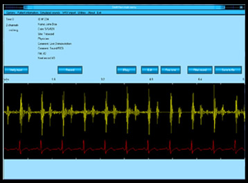 StethView Digital Recording System