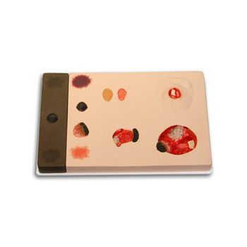 Pat Pressure Ulcer Staging Model