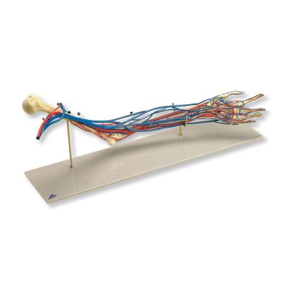 Vascular Arm