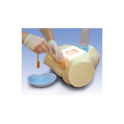 Male Urethral and Suprapubic Catheterization