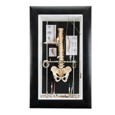Spine in a Frame (Medium Size Wall Display)